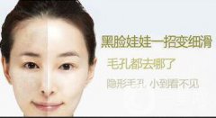 黑臉娃娃的功與作用介紹，關(guān)于皮膚管理的干貨也有哦