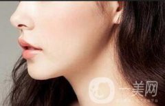 墊下巴多長時間恢復(fù)？