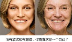 怎樣減少臉上的皺紋 除皺方式盤點附價格介紹