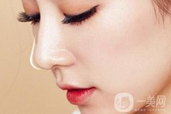 隆鼻價(jià)格是多少？隆鼻大概多少錢？