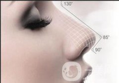 自體隆鼻要多少錢？大致價(jià)位是多少？