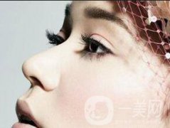 鼻翼縮小手術(shù)整形要多少錢 ?