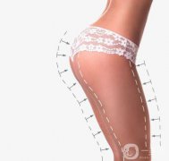 上海自體脂肪填屁股多少錢？貴不貴？