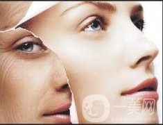 拉皮手術(shù)果一般可以維持多久