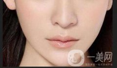 下巴打玻尿酸多少錢!玻尿酸墊下巴價位是多少