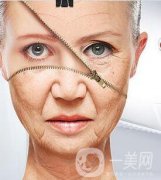 皮膚松弛與褶皺 射頻和電波拉皮信息介紹？