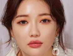 埋線雙眼皮貴嗎？