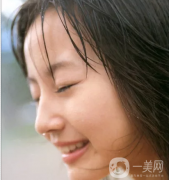 硅膠豐太陽穴貴嗎 硅膠豐太陽穴價格