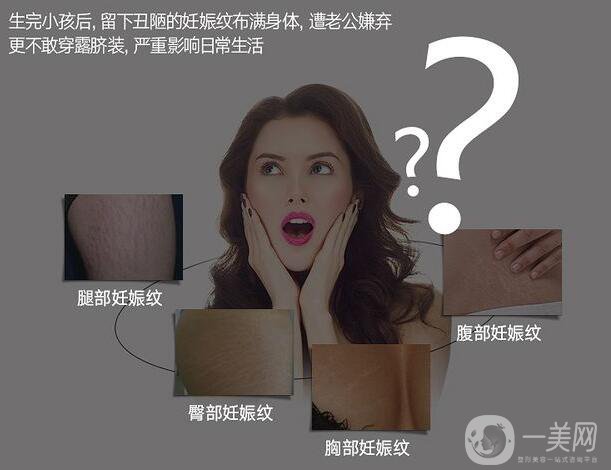 去妊娠紋價(jià)錢是多少？