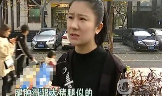 驚！女子花5萬整形，大腿留下17厘米疤痕