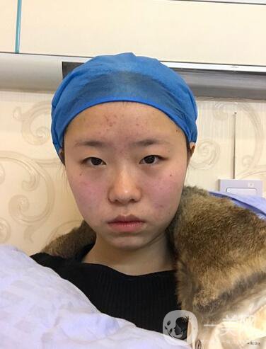整容到底為了什么？知乎回答扎進心窩