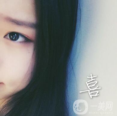 整容到底為了什么？知乎回答扎進心窩