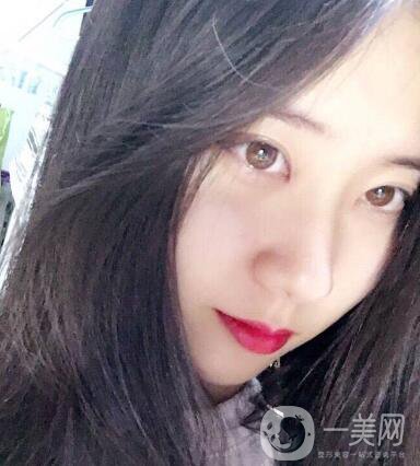 整容到底為了什么？知乎回答扎進心窩