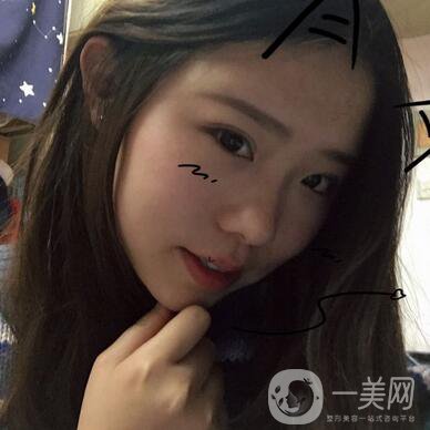 整容到底為了什么？知乎回答扎進心窩