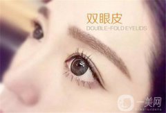 什么叫埋線雙眼皮 埋線雙眼皮怎么樣？