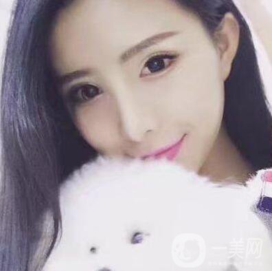 什么是芭比眼平行雙眼皮？
