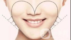 自體脂肪面部填充果好不好？有哪些果？