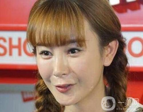明星整容就是不承認(rèn)？ 然后突然臉“爛”了！
