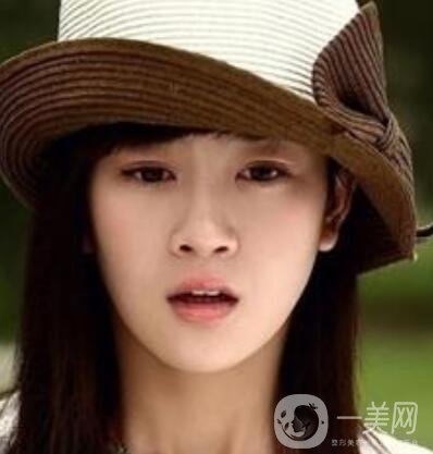 明星整容就是不承認(rèn)？ 然后突然臉“爛”了！
