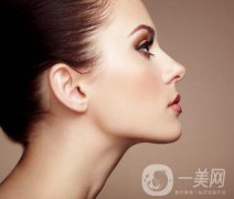 成都激光去痘坑要多少錢 果好嗎