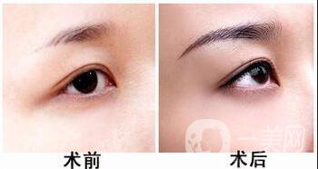 立體繡眉多少錢,立體繡眉*果怎么樣