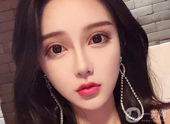 注射隆鼻好嗎 有哪些缺點(diǎn)呢？