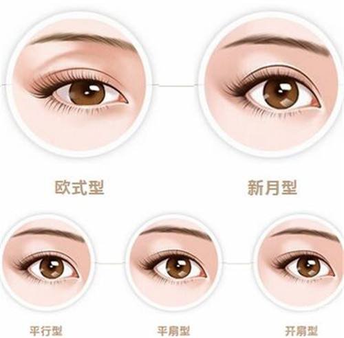 冬季割雙眼皮注意什么？術(shù)后吃什么好？