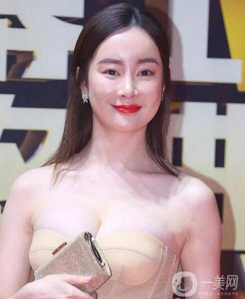 賈靜雯、迪麗熱巴的雙眼皮是不是割的 看了這個(gè)你就明白了