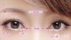 韓式*開(kāi)眼角手術(shù)的價(jià)格高嗎？