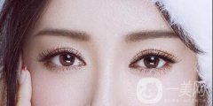 高分子割雙眼皮可以維持多長時間呢?注意事項有哪些？