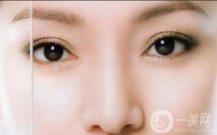 雙眼皮怎么樣？果如何呢？