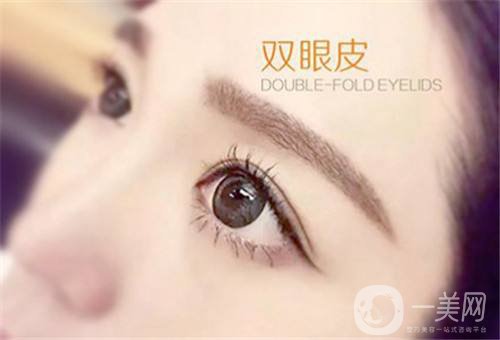 三點(diǎn)定位雙眼皮多少錢 雙眼皮手術(shù)方法