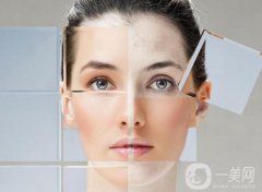 去法令紋多少錢(qián) 去法令紋的手術(shù)方法