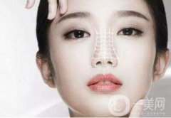 硅橡膠隆鼻要多少錢(qián) 硅橡膠隆鼻材料