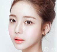 韓式開眼角手術(shù)果怎么樣？