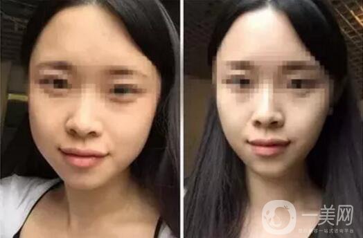 **果好嗎？*前后圖