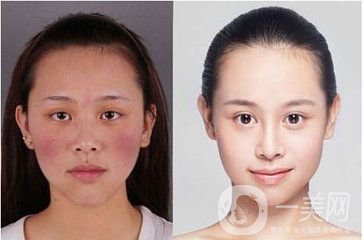 臉上很多紅血絲怎么辦？給你1個(gè)小法寶和紅血絲說(shuō)再見(jiàn)