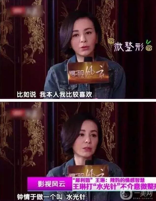 為什么眾多明星都鐘愛*？