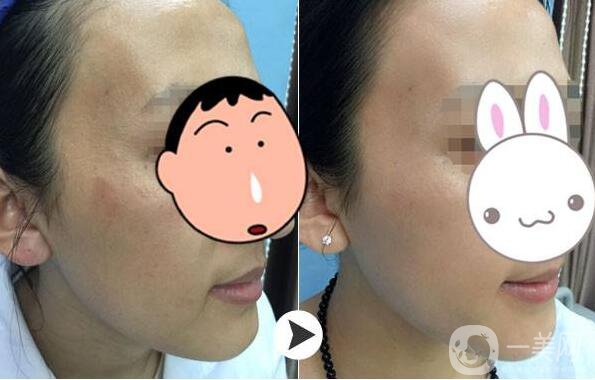 為什么眾多明星都鐘愛*？