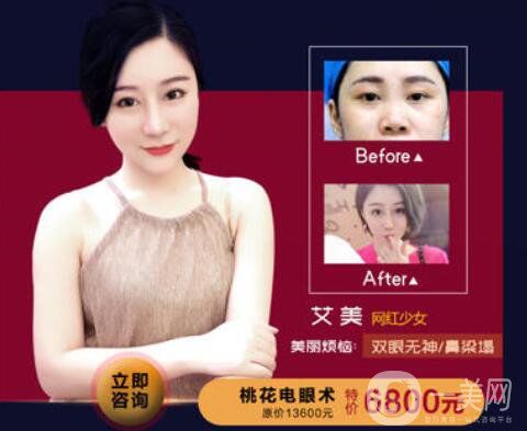 佛山夢露整形醫(yī)院跨年狂歡月 積贊當(dāng)錢花