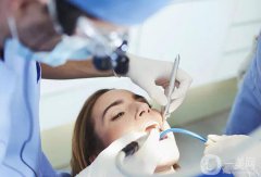 烤瓷牙多久換一次比較好呢？