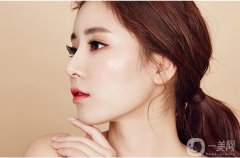 成都割雙眼皮多少錢？費用高嗎？