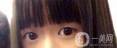 整容整得好看是怎樣一種體驗(yàn)？眾知乎美女回答讓你羨慕嫉妒恨！