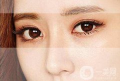做三點定位雙眼皮眼睛疼嗎？可以打麻醉嗎？