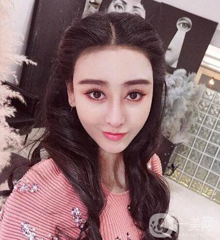 又一個(gè)整容失敗的女明星，鼻子都整歪了，不甘心揚(yáng)言還要植發(fā)！