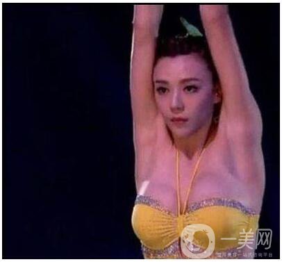 周韋彤整容