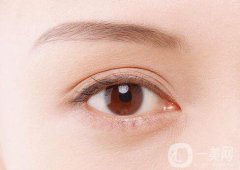 雙眼皮手術(shù)恢復(fù)時間-雙眼皮術(shù)后注意事項
