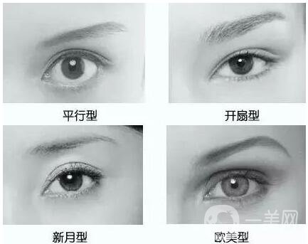 雙眼皮手術(shù)恢復(fù)時(shí)間