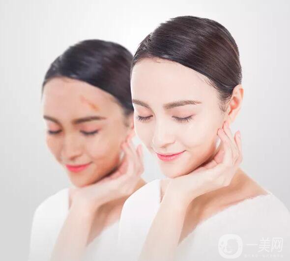 增生疤痕注意事項有哪些？該如何預(yù)防及調(diào)節(jié)？