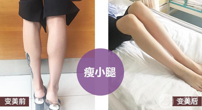 打*有副作用嗎？都有哪些副作用呢？